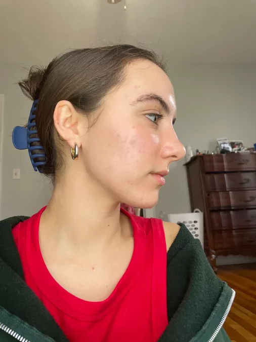 Gullo shows off her current skin state.